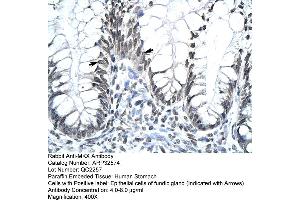 Human Stomach (MKX Antikörper  (Middle Region))