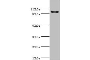 Western Blotting (WB) image for anti-Adaptor-Related Protein Complex 2, beta 1 Subunit (AP2B1) (AA 738-937) antibody (ABIN7144363)