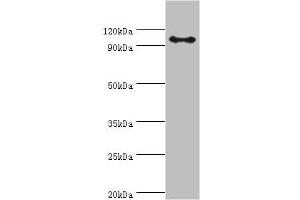 Western blot All lanes: AP-2 complex subunit beta antibody at 8 μg/mL + Mouse brain tissue Secondary Goat polyclonal to rabbit IgG at 1/10000 dilution Predicted band size: 105, 106, 99 kDa Observed band size: 105 kDa (AP2B1 Antikörper  (AA 738-937))