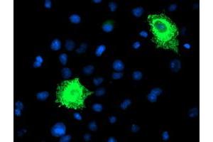 Anti-FBXO21 mouse monoclonal antibody (ABIN2455379) immunofluorescent staining of COS7 cells transiently transfected by pCMV6-ENTRY FBXO21 (RC223095). (FBXO21 Antikörper)