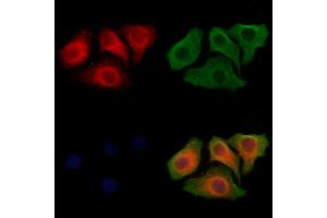 ABIN6264415 and ABIN6278511 staining Hela cells by IF/ICC. (SLC26A5 Antikörper  (Internal Region))