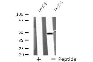 Western blot analysis of extracts from HepG2 cells, using KCNN4 antibody.
