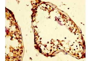 IHC image of ABIN7145750 diluted at 1:500 and staining in paraffin-embedded human testis tissue performed on a Leica BondTM system. (UIMC1 Antikörper  (AA 161-235))