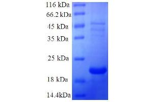 LGALS7 Protein (AA 2-136, full length) (His tag)
