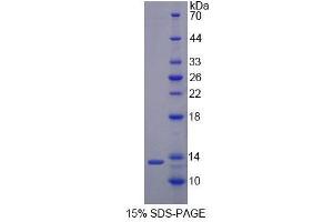SDS-PAGE (SDS) image for Resistin (RETN) (AA 21-114) protein (His tag) (ABIN1080629) (Resistin Protein (RETN) (AA 21-114) (His tag))