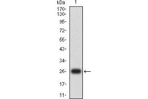 Western blot analysis using TIA1 mAb against human TIA1 (AA: 1-215) recombinant protein. (TIA1 Antikörper  (AA 1-215))
