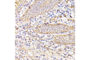 Immunohistochemistry of paraffin-embedded human appendix using PSMG1 antibody (ABIN7269593) at dilution of 1:100 (40x lens). (PSMG1 Antikörper  (AA 1-288))