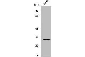 Western Blot analysis of HuvEc cells using DIO3 Polyclonal Antibody (DIO3 Antikörper  (Internal Region))