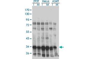 Western Blotting (WB) image for anti-High Mobility Group 20B (HMG20B) (AA 1-110) antibody (ABIN599130) (HMG20B Antikörper  (AA 1-110))