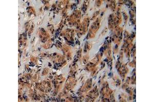 Used in DAB staining on fromalin fixed paraffin- embedded breast cancer tissue (Fibrillin 2 Antikörper  (AA 1550-1791))