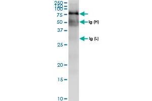 Immunoprecipitation of TRAP1 transfected lysate using anti-TRAP1 MaxPab rabbit polyclonal antibody and Protein A Magnetic Bead , and immunoblotted with TRAP1 MaxPab rabbit polyclonal antibody (D01) . (TRAP1 Antikörper  (AA 1-704))