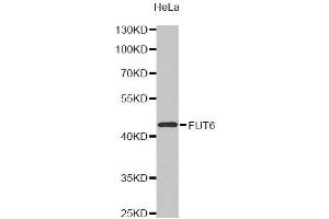Western Blotting (WB) image for anti-Fucosyltransferase 6 (Alpha (1,3) Fucosyltransferase) (FUT6) antibody (ABIN1872749) (FUT6 Antikörper)