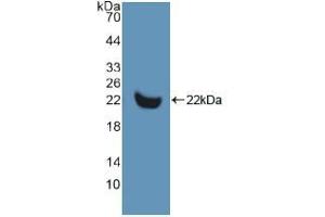 Western blot analysis of recombinant Human MMP13. (MMP13 Antikörper  (AA 290-468))