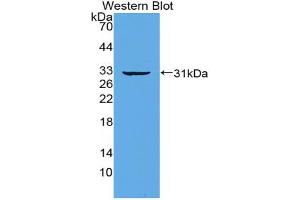 Western blot analysis of the recombinant protein. (IRF5 Antikörper  (AA 3-250))