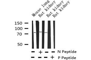 Western Blotting (WB) image for anti-Spleen tyrosine Kinase (SYK) (pTyr348) antibody (ABIN6255895)