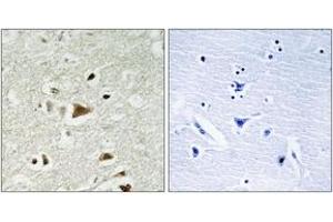 Immunohistochemistry analysis of paraffin-embedded human brain tissue, using Smad2 (Ab-220) Antibody. (SMAD2 Antikörper  (AA 186-235))