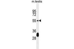 KT33A Antibody (N-term) western blot analysis in mouse testis tissue lysates (35µg/lane). (Keratin 33A Antikörper  (N-Term))