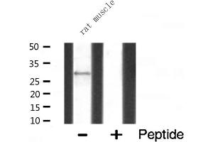 Western blot analysis of MRPL10 expression in Rat muscle lysate (MRPL10 Antikörper  (C-Term))