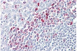 Anti-PARP6 antibody IHC staining of human tonsil. (PARP6 Antikörper  (AA 431-480))