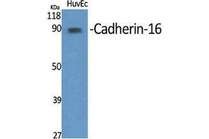 Western Blot (WB) analysis of specific cells using Cadherin-16 Polyclonal Antibody.