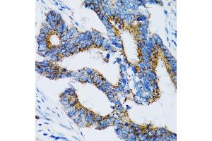 Immunohistochemistry (IHC) image for anti-E3 Ubiquitin-Protein Ligase SIAH1 (SIAH1) (AA 1-313) antibody (ABIN3016132)