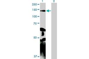Western Blot analysis of MYLK expression in transfected 293T cell line by MYLK MaxPab polyclonal antibody. (MYLK Antikörper  (AA 1-992))