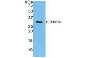 Western blot analysis of recombinant Human CA3. (CA3 Antikörper  (AA 2-260))