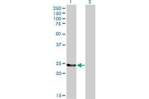 Western Blot analysis of GSTM4 expression in transfected 293T cell line by GSTM4 monoclonal antibody (M01), clone 4B4.