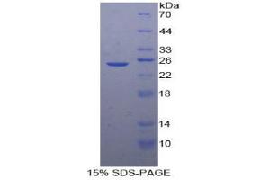 SDS-PAGE analysis of Human SDF2 Protein. (SDF2 Protein)