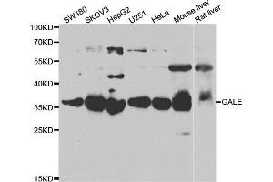 Western blot analysis of extracts of various cell lines, using GALE antibody. (GALE Antikörper)