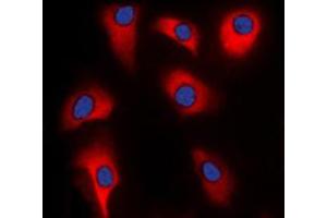 Immunofluorescent analysis of p39 staining in HeLa cells. (p39 (Center) Antikörper)