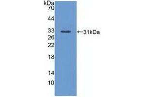 Detection of Recombinant PLCe1, Mouse using Polyclonal Antibody to Phospholipase C Epsilon 1 (PLCe1) (PLCE1 Antikörper  (AA 1-250))