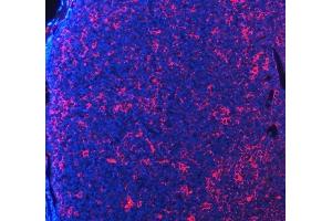 IF analysis of PDCD1 using anti-PDCD1 antibody (ABIN5518784). (PD-1 Antikörper  (N-Term))