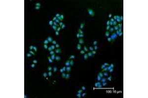 Immunofluorescent analysis (confocal) staining of HeLa cells using Cu/Zn SOD pAb (green), nuclei are stained in blue pseudocolor using DRAQ5. (SOD1 Antikörper)