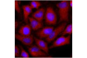 Immunofluorescence (IF) image for anti-Ornithine Aminotransferase (OAT) (AA 33-439) antibody (ABIN487353) (OAT Antikörper  (AA 33-439))
