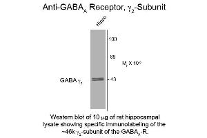 Western Blot of Anti-GABA(A) Receptor gamma 2 (Rabbit) Antibody - 112-401-C81 Western Blot of Rabbit Anti-GABA(A) Receptor gamma 2 Antibody. (GABRG2 Antikörper)