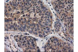 Image no. 17 for anti-Destrin (Actin Depolymerizing Factor) (DSTN) antibody (ABIN1497910) (Destrin Antikörper)