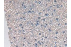 Detection of OAT in Human Liver Tissue using Polyclonal Antibody to Ornithine Aminotransferase (OAT)