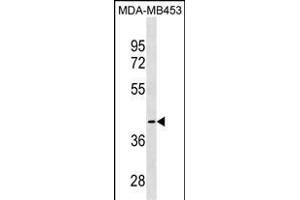 CCBL1 Antibody (C-term) (ABIN1537137 and ABIN2849997) western blot analysis in MDA-M cell line lysates (35 μg/lane). (CCBL1 Antikörper  (C-Term))