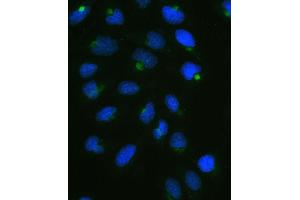anti-Protein Phosphatase 1, Regulatory (Inhibitor) Subunit 14A (PPP1R14A) (AA 30-126) antibody