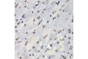 Immunohistochemistry of paraffin-embedded mouse brain using PSMB10 antibody (ABIN6132527, ABIN6146311, ABIN6146312 and ABIN6221107) at dilution of 1:200 (40x lens). (PSMB10 Antikörper  (AA 1-273))