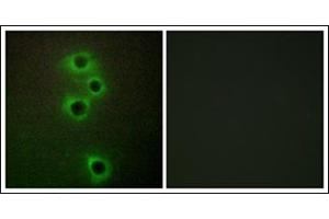 Immunofluorescence analysis of A549 cells, using MARK4 Antibody. (MARK4 Antikörper  (Internal Region))