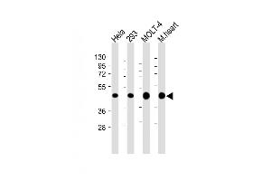 All lanes : Anti-MTHFD2 Antibody (C-term) at 1:4000 dilution Lane 1: Hela whole cell lysate Lane 2: 293 whole cell lysate Lane 3: MOLT-4 whole cell lysate Lane 4: Mouse heart lysate Lysates/proteins at 20 μg per lane.