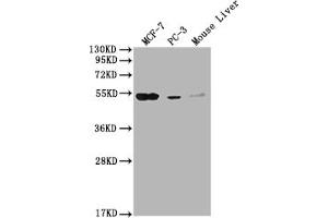 Western Blot Positive WB detected in: MCF-7 whole cell lysate, PC-3 whole cell lysate, Mouse Liver tissue All lanes: MOCS3 antibody at 1:2000 Secondary Goat polyclonal to rabbit IgG at 1/50000 dilution Predicted band size: 50 kDa Observed band size: 50 kDa (MOCS3 Antikörper  (AA 279-404))