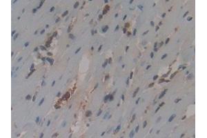 Detection of CYCS in Mouse Heart Tissue using Polyclonal Antibody to Cytochrome C (CYCS) (Cytochrome C Antikörper  (AA 13-99))