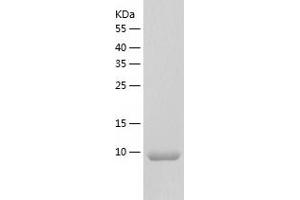 Western Blotting (WB) image for Chemokine (C-C Motif) Ligand 4 (CCL4) (AA 24-92) protein (His-IF2DI Tag) (ABIN7122303)