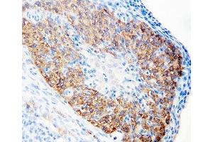 IHC-P: hCG receptor antibody testing of rat ovary tissue (hCG Receptor (N-Term) Antikörper)
