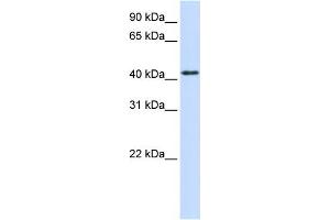 WB Suggested Anti-PTPRR Antibody Titration:  0. (PTPRR Antikörper  (N-Term))