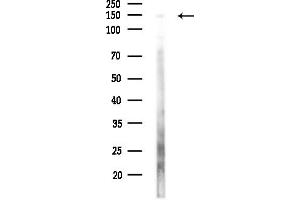 Western blot analysis of lysates from HepG2 cells(LPS,4h treatment), using KDM6A / UTX Antibody at 1/1000 dilution.