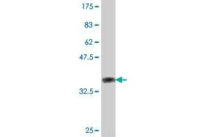 Western Blot detection against Immunogen (37. (Sonic Hedgehog Antikörper  (AA 181-280))